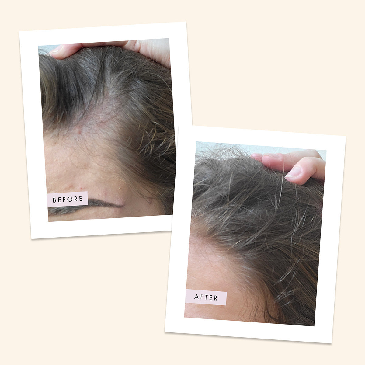 Scalp Foam Hair Gain