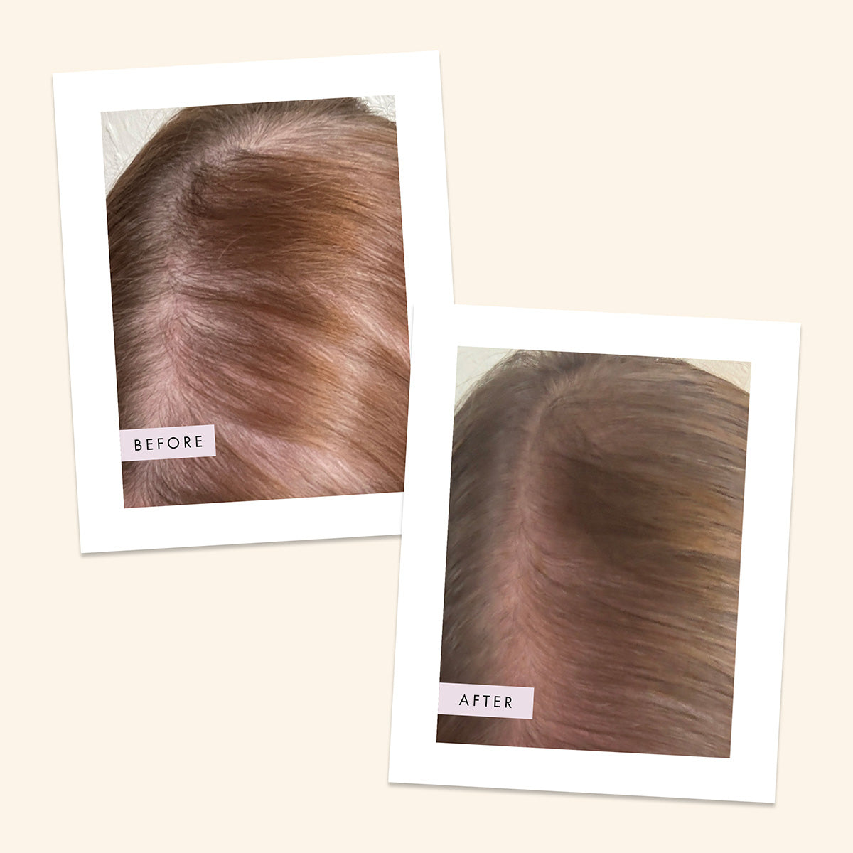 Scalp Foam Hair Gain